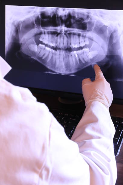 Best Broken or Cracked Tooth Emergency Dentist in Brookneal, VA