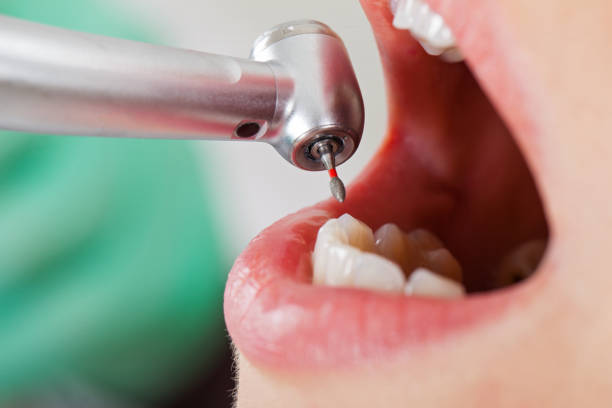 Best Mobile Emergency Dentist in Brookneal, VA